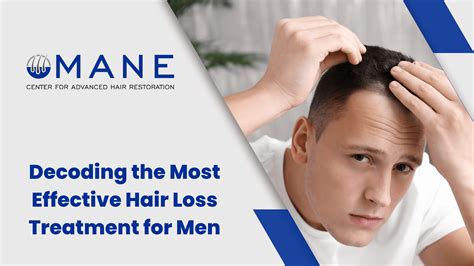 Hair Replacement Men: 8 Revolutionary Solutions for Balding