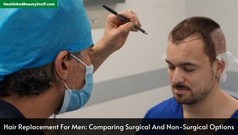 Hair Replacement for Men: A Comprehensive Guide to Non-Surgical Solutions