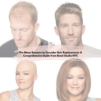 Hair Replacement for Women: A Comprehensive Guide to Rediscovering Your Confidence