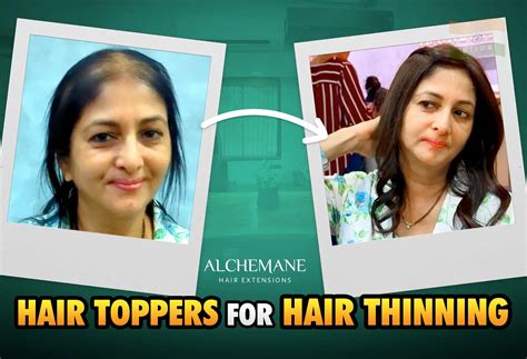 Hair Toppers for Women: 4000+ Instant Hair Solutions