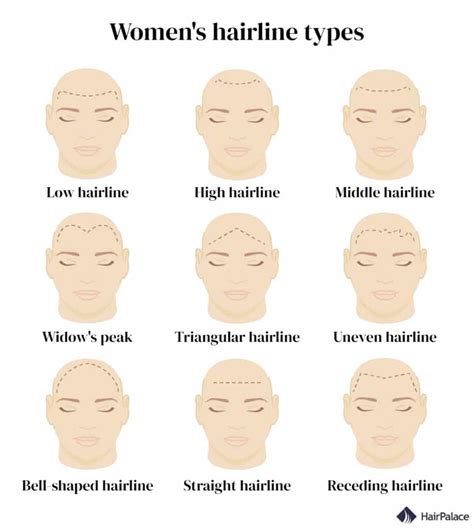 Hairline shape: