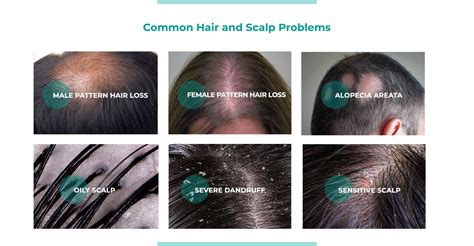 Hairyangela: A Revolutionary Solution for Hair Loss and Scalp Conditions