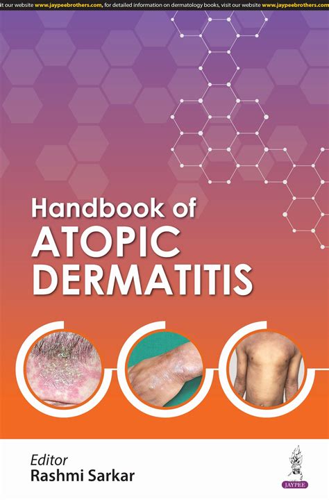 Handbook of Atopic Eczema Reader