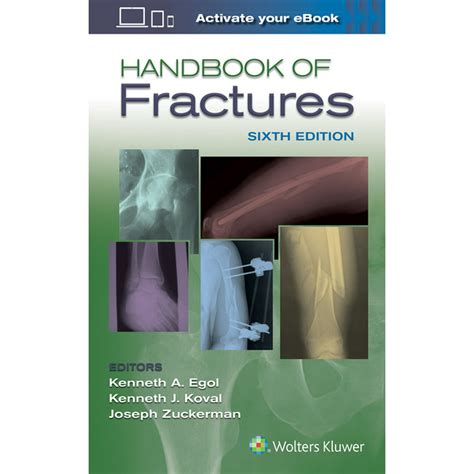 Handbook of Fractures PDF
