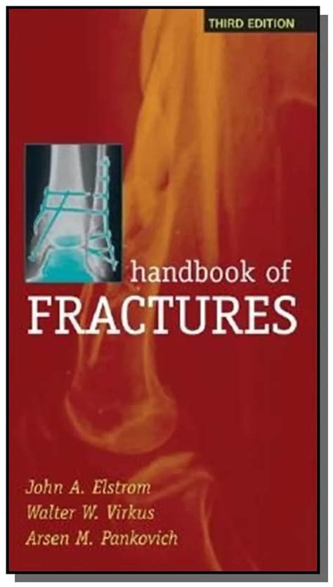 Handbook of Fractures 3rd Edition Reader