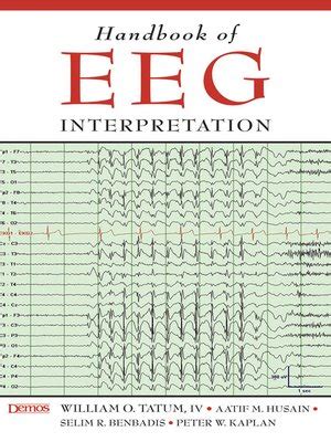 Handbook.of.EEG.Interpretation Ebook PDF