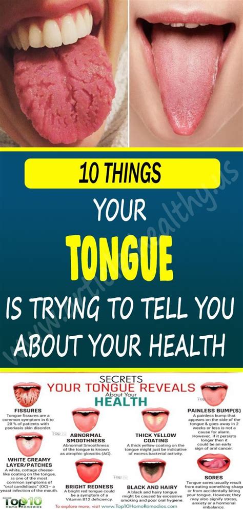 Healing the Tongue Kindle Editon