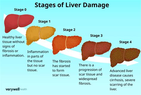 Health and Damage: