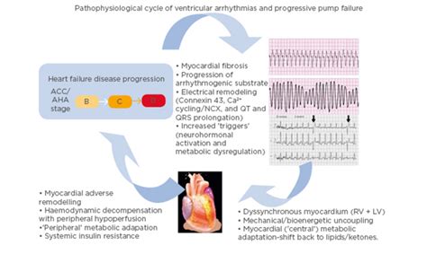 Heart Failure and Arrhythmias Doc