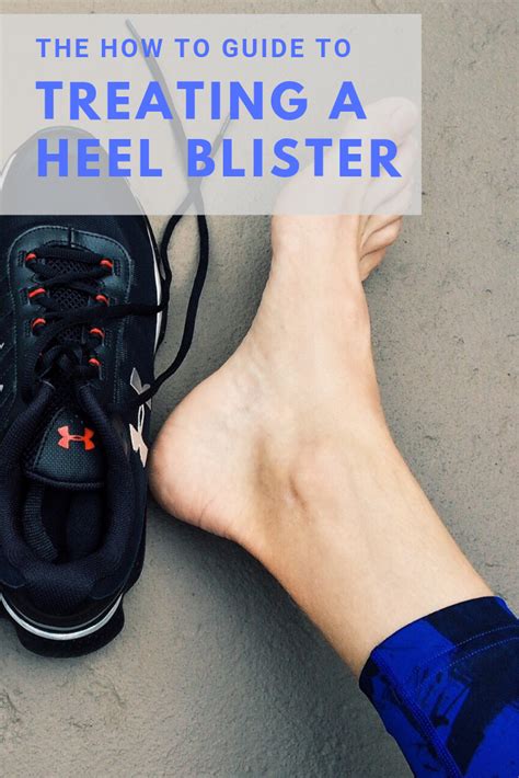 Heel Blisters from Shoes: Ultimate Guide to Prevention, Treatment, and Recovery