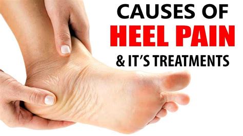 Heel Pain: Understanding, Treatment, and Prevention