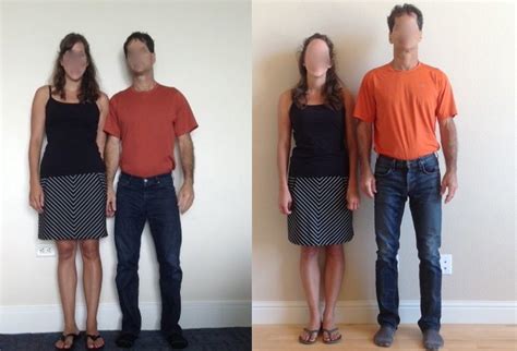 Height and Leg Lengthening: