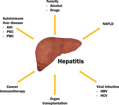 Hepatitis (liver inflammation):