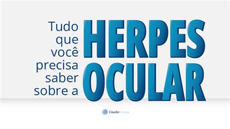 Herpes Olhos: Tudo o que você precisa saber sobre essa infecção ocular