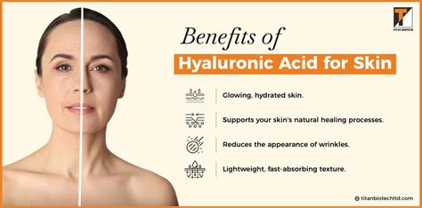 Hialexis: Unveiling the Power of Hyaluronic Acid for Skin Health and Joint Mobility