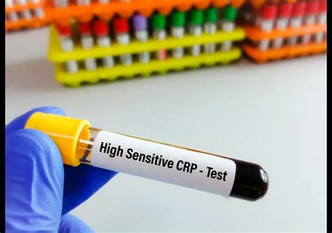 High Sensitivity: