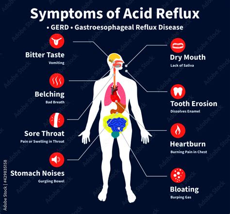 High acidity: