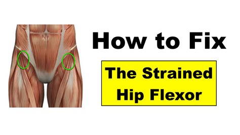 Hip Flexor Pain Running: A Comprehensive Guide to Causes, Treatment, and Prevention