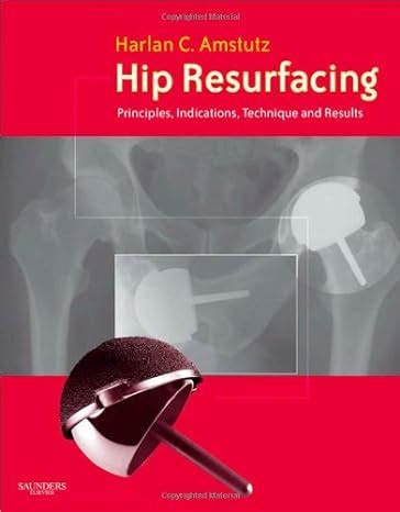 Hip Resurfacing Principles Reader