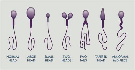 How Covered Incum Works