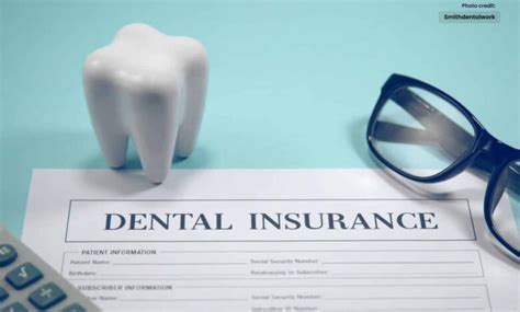 How Dental PPO Insurance Works