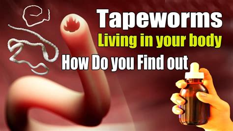 How Do I Know If I Have A Tapeworm VS. 2025: Progress & Pain Points