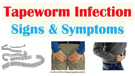 How Do I Know If I Have a Tapeworm: 8 Telltale Signs