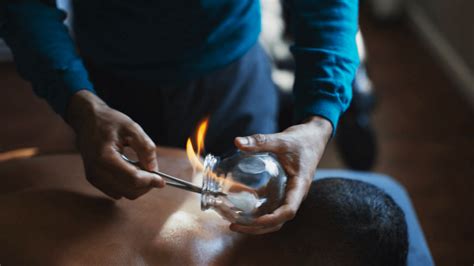 How KingMoXu Fire Cupping Matters