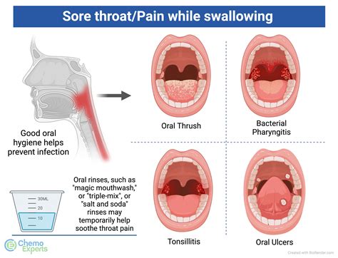 How Long Does a Sore Throat Last: 2025 Ultimate Guide