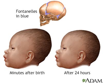 How Long For Newborn Head to Shape: 825 Days VS. 2025 Days