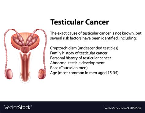 How Quickly Does Testicular Cancer Grow: 2025 Update