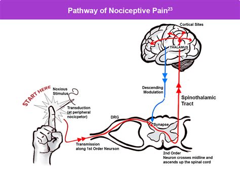 How to Choose the Right Examination for Visualizing Nociceptive Pain