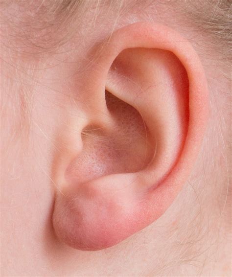 How to Cure a Blocked Ear: 10 Proven Methods for 2025