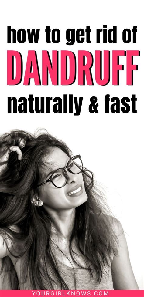 How to Get Rid of Dandruff Fast 2025: 7 Instant Remedies