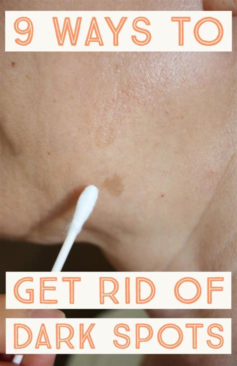 How to Get Rid of Dark Spots (10 Proven Methods)