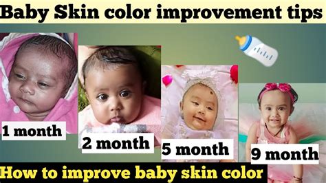 How to Improve Baby's Skin Color in 7 Easy Steps