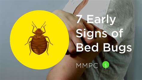 How to Know if You Have Bed Bugs: 10 Signs You Shouldn't Ignore