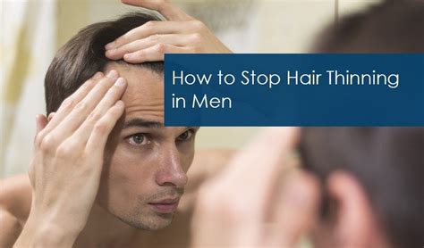 How to Prevent Hair Thinning in Men: An In-Depth Guide