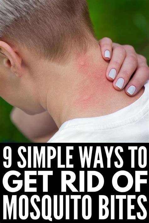 How to Stop Mosquito Bites From Itching: 10 Proven Methods