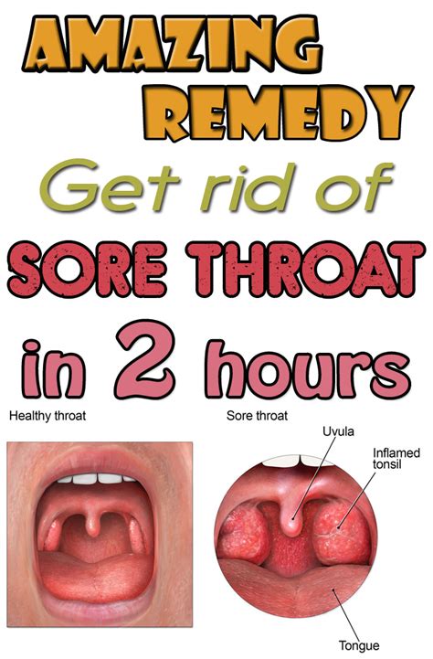 How to Stop a Sore Throat Fast: 12 Effective Ways (2025)