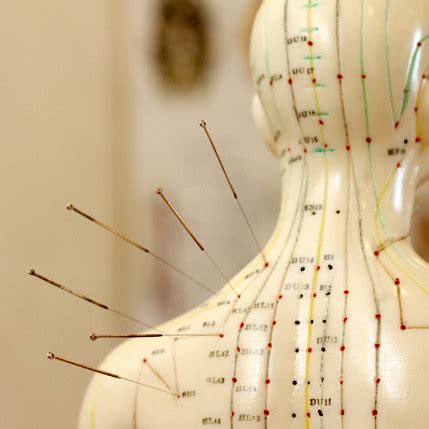 Hua Mei Acupuncture and TCM Centre: Your Guide to Holistic Healing