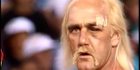 Hulk Hogan Black Eye: The Inside Story