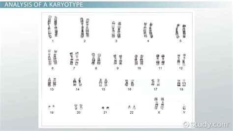 Human Karyotypes Investigation 11 Answer Key PDF