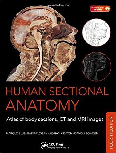 Human Sectional Anatomy Pocket Atlas of Body Sections, CT and MRI Images Doc