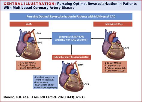 Hybrid Cardiac Interventions PDF