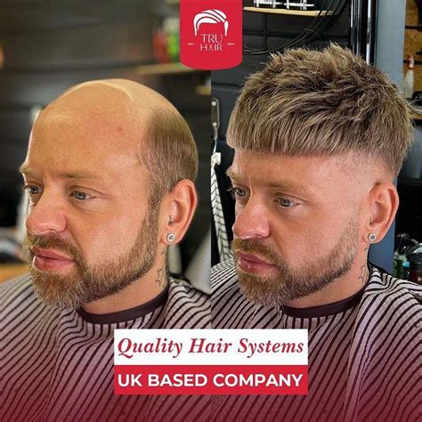 Hybrid Hair System Men: The Ultimate Solution for Balding