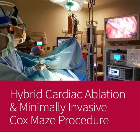 Hybrid and Minimally Invasive Cardiac Interventions Epub