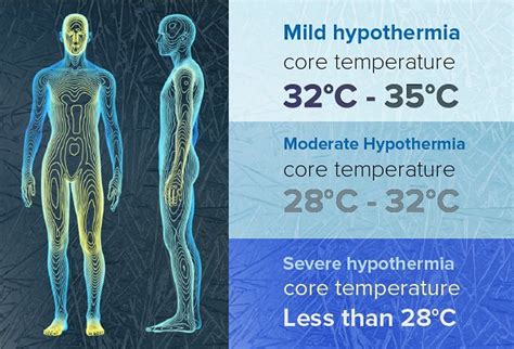 Hypothermia Kindle Editon