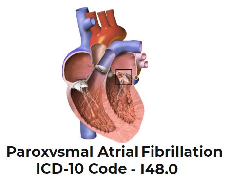 I48.0: Atrial fibrillation