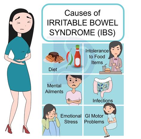 ICD-10 1001: Navigating Irritable Bowel Syndrome